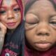 Mother Going Blind After Tattooing Her Eyeballs Blue And Purple To Copy An Influencer