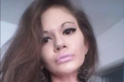 Before and After Photos of Lady Who Spent ₦39M to Look Like a Bratz Doll Stir Reactions