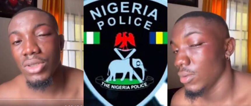 Man Accuses Owerri Police Of Brutality And Extortion