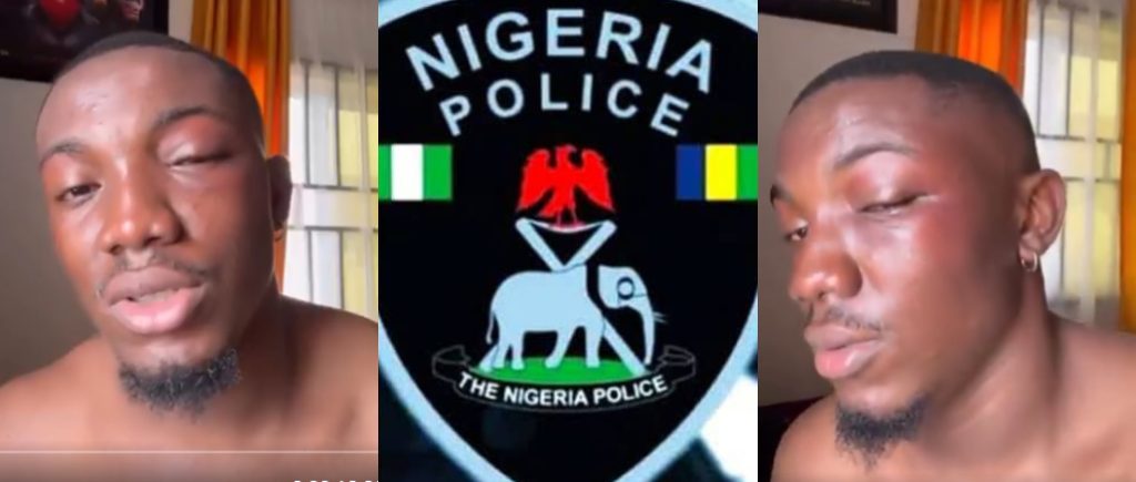 Man Accuses Owerri Police Of Brutality And Extortion