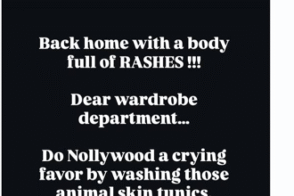 “My Skin Paid The Price”- Gideon Okeke Warns Nollywood On Set Hygiene After Rash Outbreak