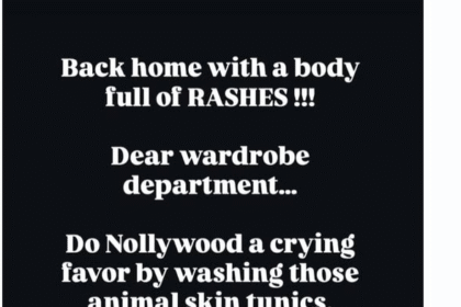 “My Skin Paid The Price”- Gideon Okeke Warns Nollywood On Set Hygiene After Rash Outbreak