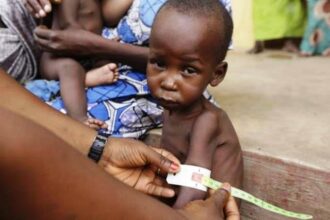 Report: 64.8 million African children not growing properly