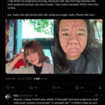 Woman Posts Pictures Of Facial Transformation During Pregnancy