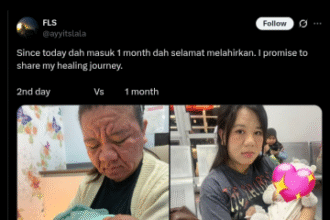 Woman Posts Pictures Of Facial Transformation During Pregnancy