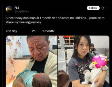 Woman Posts Pictures Of Facial Transformation During Pregnancy