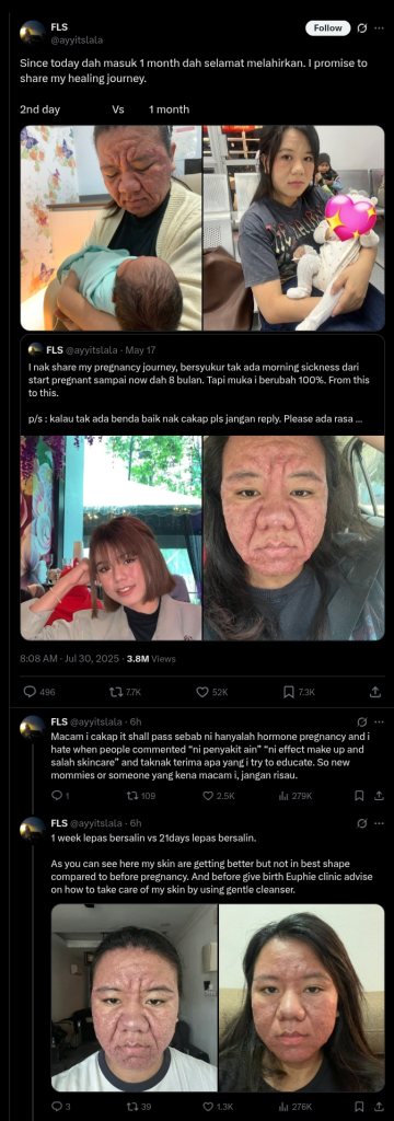 Woman Posts Pictures Of Facial Transformation During Pregnancy
