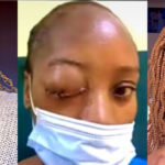 Woman Shares How She Went Blind During Pregnancy, Lost Baby