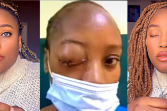 Woman Shares How She Went Blind During Pregnancy, Lost Baby