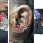 Lil Kesh reportedly stabbed in Lagos [PHOTOS]