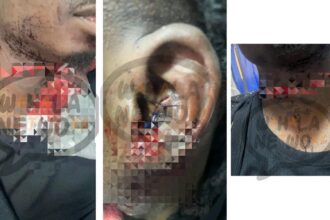 Lil Kesh reportedly stabbed in Lagos [PHOTOS]