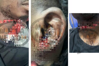 Lil Kesh reportedly stabbed in Lagos [PHOTOS]