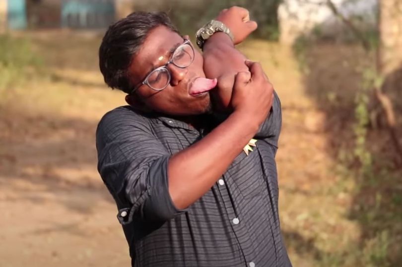 Meet The Man With 'World's Longest Tongue' Who Can Lick His One Elbow (Photos)
