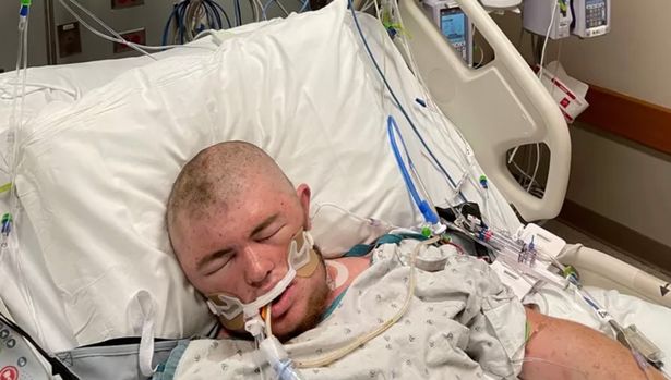 Story Of 21-Year-Old Man Who Ended Up In A Coma After Being Stung By Raging Bees 20,000 Times