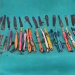 Doctors remove 29 spoons, 19 toothbrushes, and pens from a Drug addict’s stomach