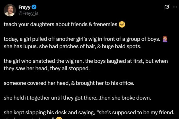 “She knew I had lupus” – Girl brǝaks down after her friend snatched her wig in public