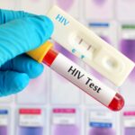 HIV infections could rise by 3.3m by 2030 – UNPFA warns