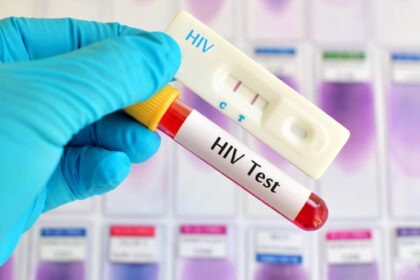 HIV infections could rise by 3.3m by 2030 – UNPFA warns