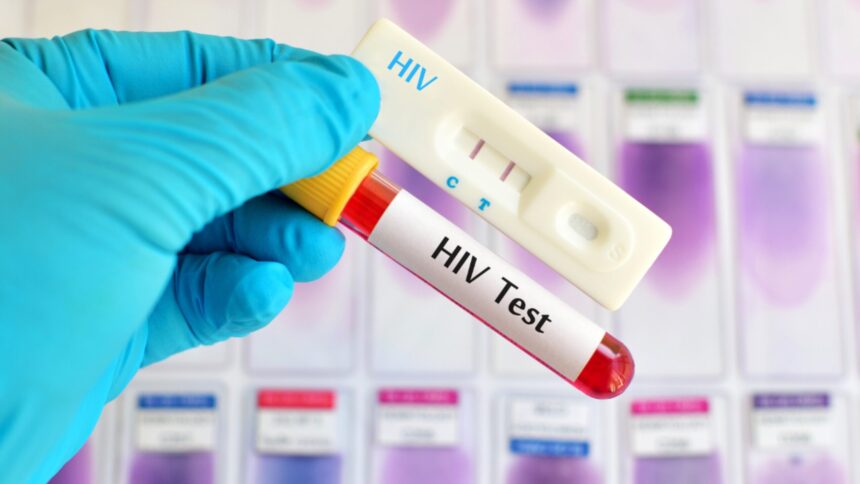 HIV infections could rise by 3.3m by 2030 – UNPFA warns