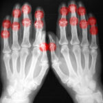 Radiography expert warns of manpower crisis as demand surges