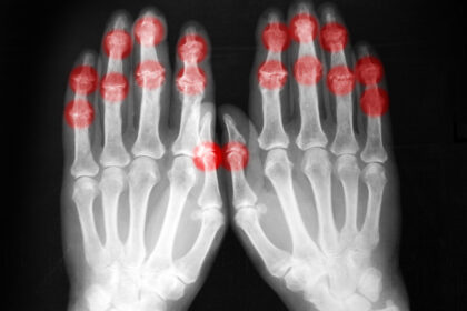 Radiography expert warns of manpower crisis as demand surges