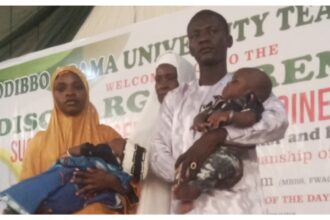 MAUTH Yola discharges successfully separated conjoined twins