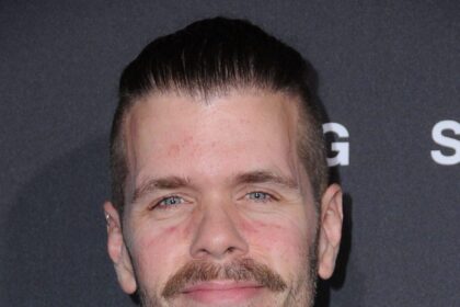 Perez Hilton Faces ‘Months, Maybe Years’ Of Recovery After Hospitalization